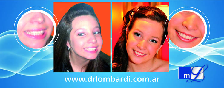 Ortodoncia antes y despues