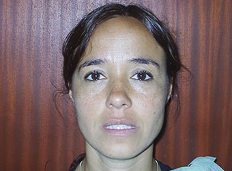 pre tratamiento ortodoncia rosario