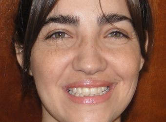 rosario ortodoncia casos despues