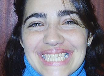 rosario ortodoncia casos antes