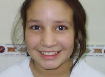 rosario ortodoncia casos antes
